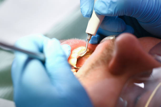 Best Mobile Emergency Dentist in Bradley, IL