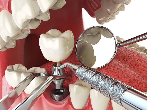 Best Emergency Dentist for Special Needs Patients in Bradley, IL
